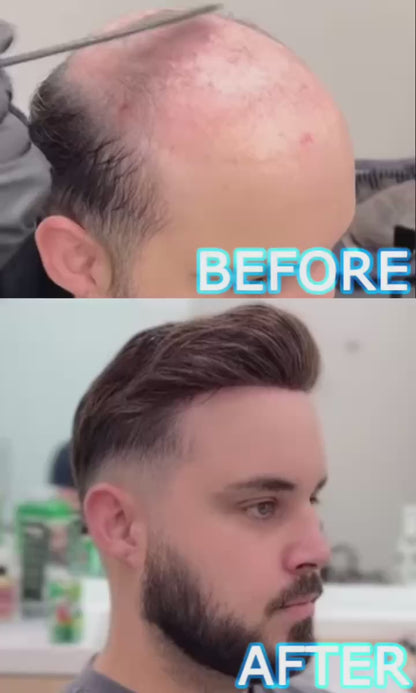 SINGA HAIR Mens Hair System Fine Monofilament Front Mens Human Hair Toupee Non-Surgical Hair Replacement For Mens Hairpiece
